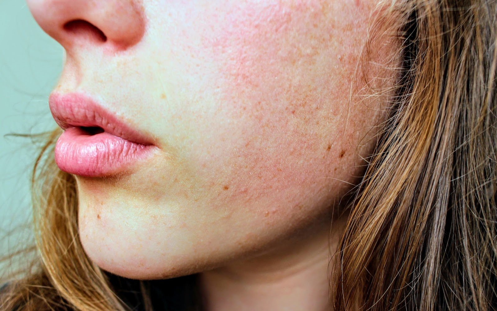 How To Combat Common Skin Conditions Using Microdermabrasion - Kenzzi