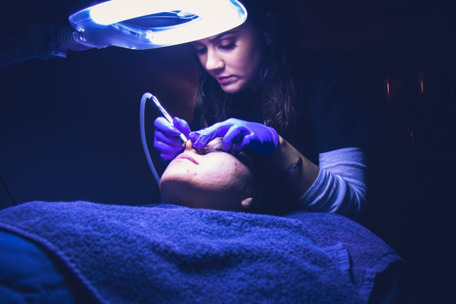 What are the Benefits of Microdermabrasion? - Kenzzi