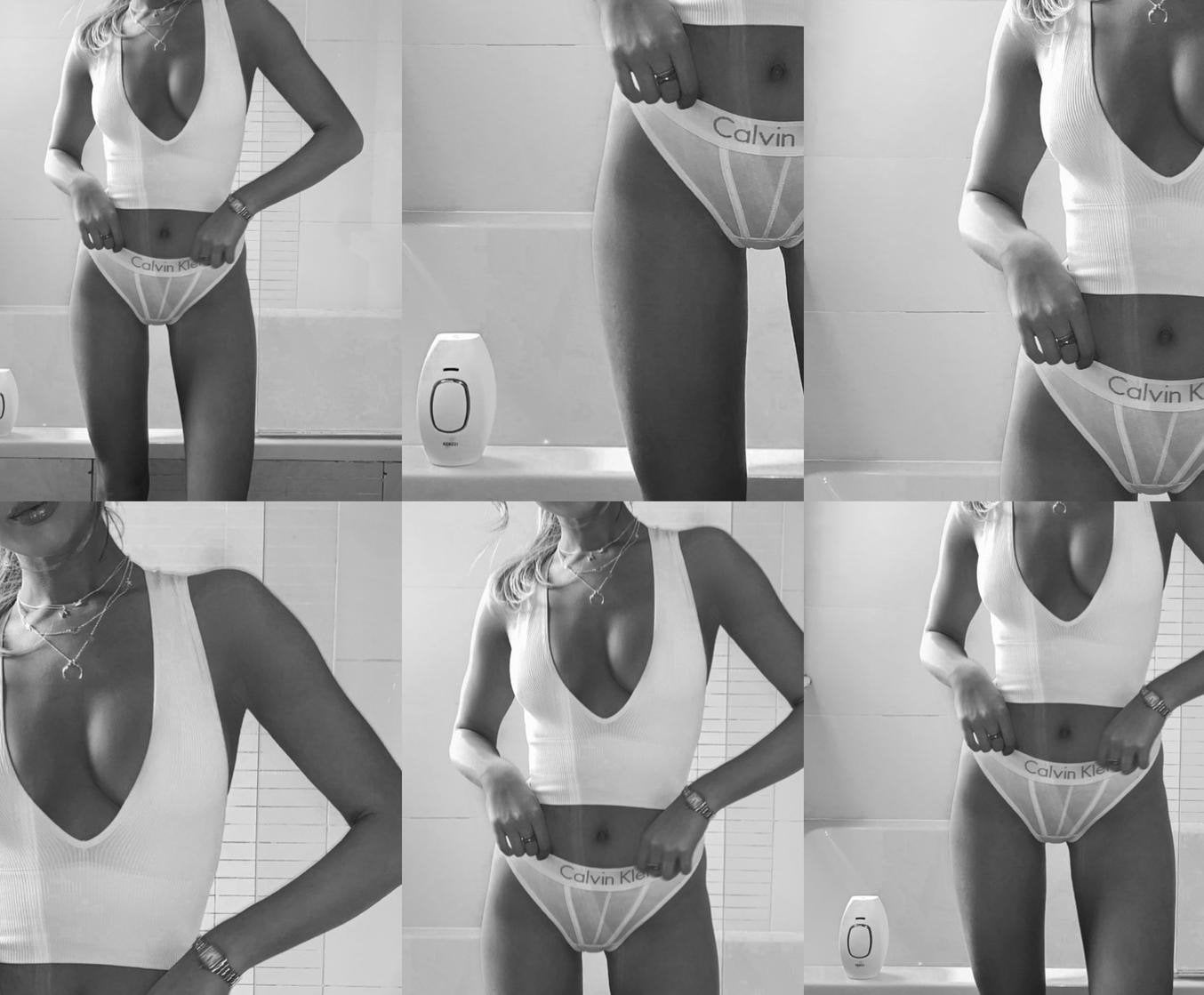 Bikini Laser Hair Removal: Getting ready for swimsuit season - Kenzzi