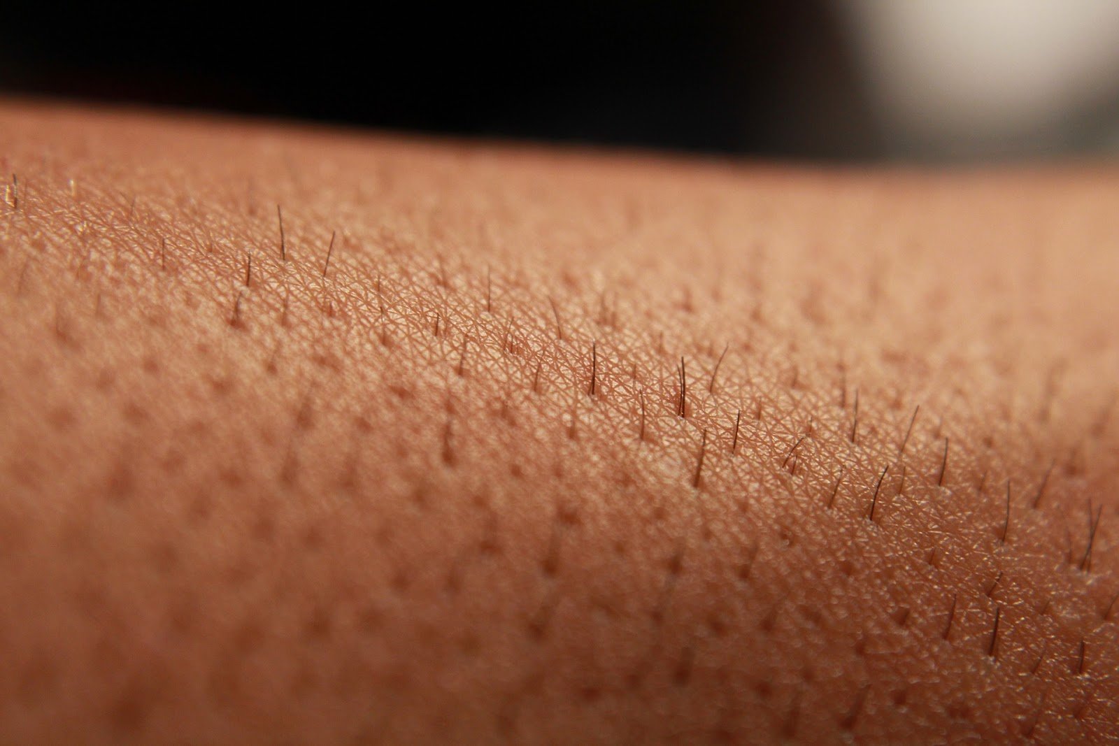 Does Laser Hair Removal Work On Light Color Hair? - Kenzzi