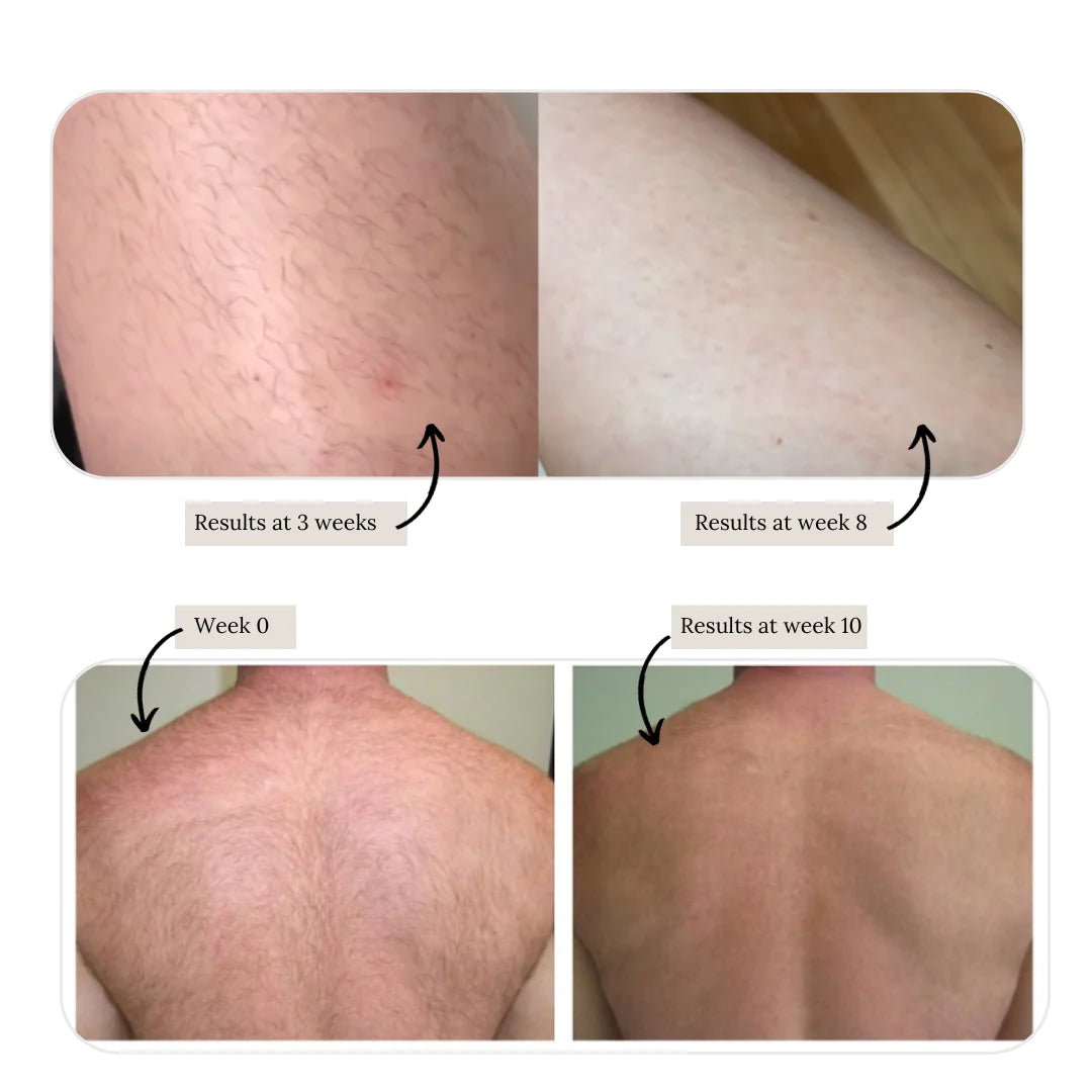 IPL Pro+ Hair Removal Handset